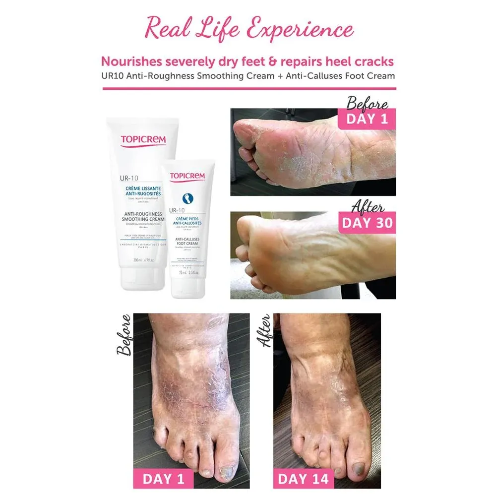 Topicrem_UR10_-_Anti-calluses_Foot_Cream_.webp